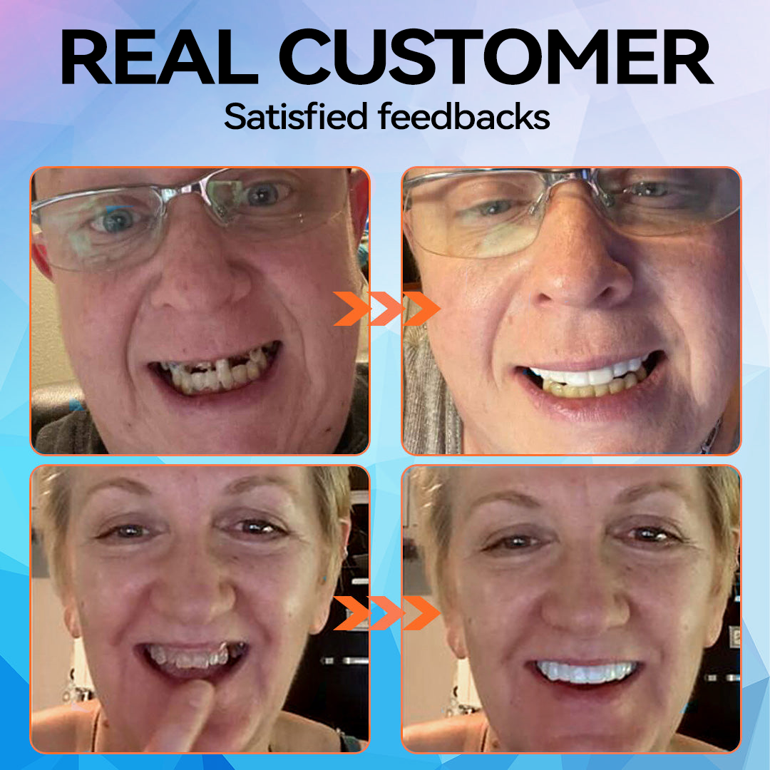 𝐁𝐢𝐤𝐞𝐧𝐝𝐚™🗽 Silicone Reline Denture Set (⏰Limited Time 80% Off - Last 30 Minutes ⏰)