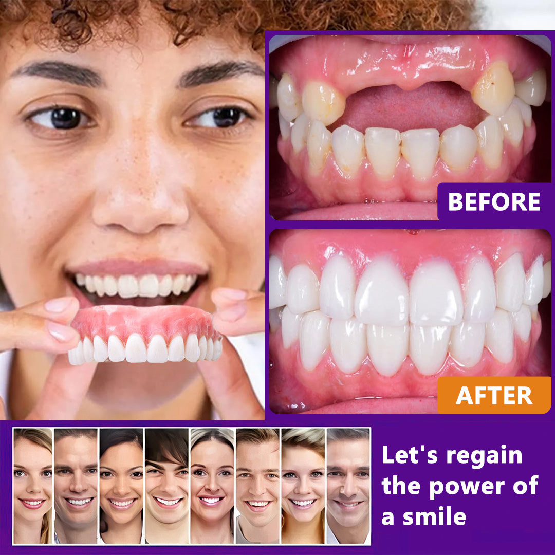 Official Store：✅TIMNAMY™ Silicone Reline Denture Set (⏰ Limited Time Discount Last 30 Minutes ⏰)