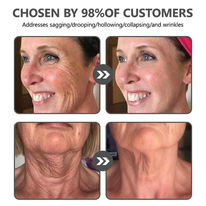 👨‍⚕️ Made and Shipped from USA✅ Lenaro™ Botox Bee Venom Wrinkle Removal Cream- LAST DAY 80% OFF