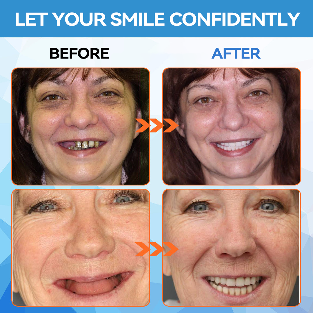 𝐁𝐢𝐤𝐞𝐧𝐝𝐚™🗽 Silicone Reline Denture Set (⏰Limited Time 80% Off - Last 30 Minutes ⏰)