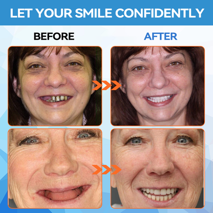 𝐁𝐢𝐤𝐞𝐧𝐝𝐚™🗽 Silicone Reline Denture Set (⏰Limited Time 80% Off - Last 30 Minutes ⏰)