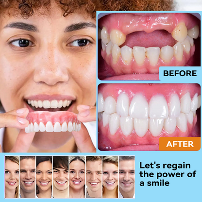 𝐁𝐢𝐤𝐞𝐧𝐝𝐚™🗽 Silicone Reline Denture Set (⏰Limited Time 80% Off - Last 30 Minutes ⏰)