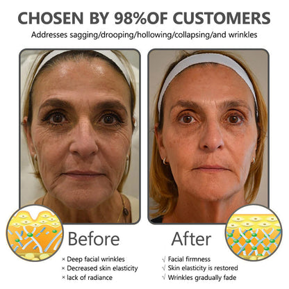 👨‍⚕️ Made and Shipped from USA✅ Lenaro™ Botox Bee Venom Wrinkle Removal Cream- LAST DAY 80% OFF