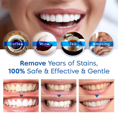 Official Store：✅ Teeth Whitening Essence(ADA recommended)(🛒Flash Sale - Don’t Miss Out)