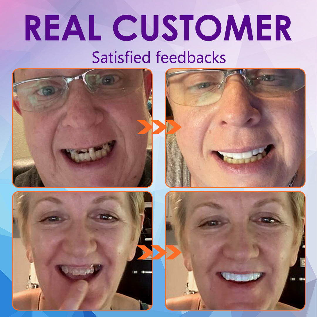 Official Store：✅TIMNAMY™ Silicone Reline Denture Set (⏰ Limited Time Discount Last 30 Minutes ⏰)