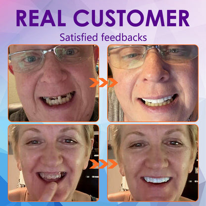 Official Store：✅TIMNAMY™ Silicone Reline Denture Set (⏰ Limited Time Discount Last 30 Minutes ⏰)