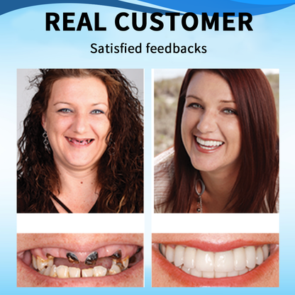 Official Store：✅TIMNAMY™ Silicone Reline Denture Set-Easy to use, no peeling, dentist recommended