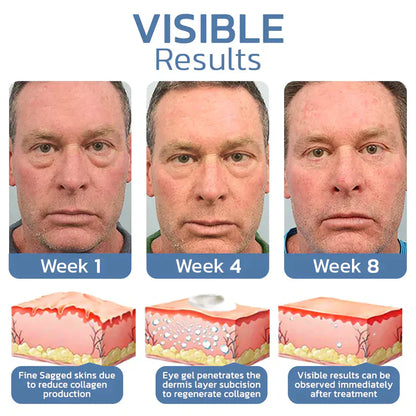JORONDY Instant Temporary Face Tightener