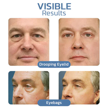 JORONDY Instant Temporary Face Tightener