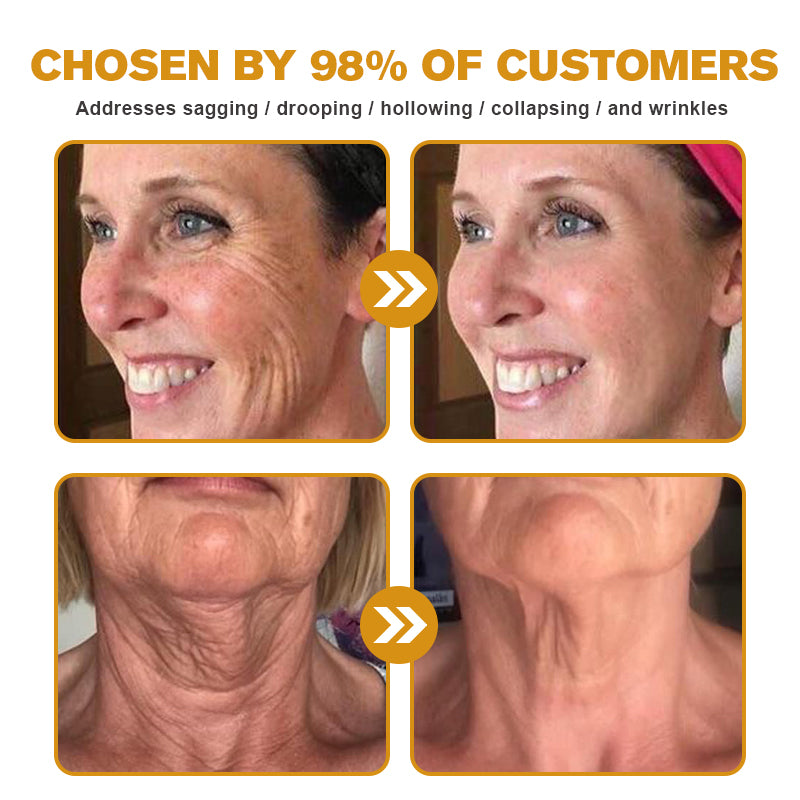 👨‍⚕️ Made and Shipped from USA✅ TLOPA™ Botox Bee Venom Wrinkle Removal Cream- LAST DAY 80% OFF
