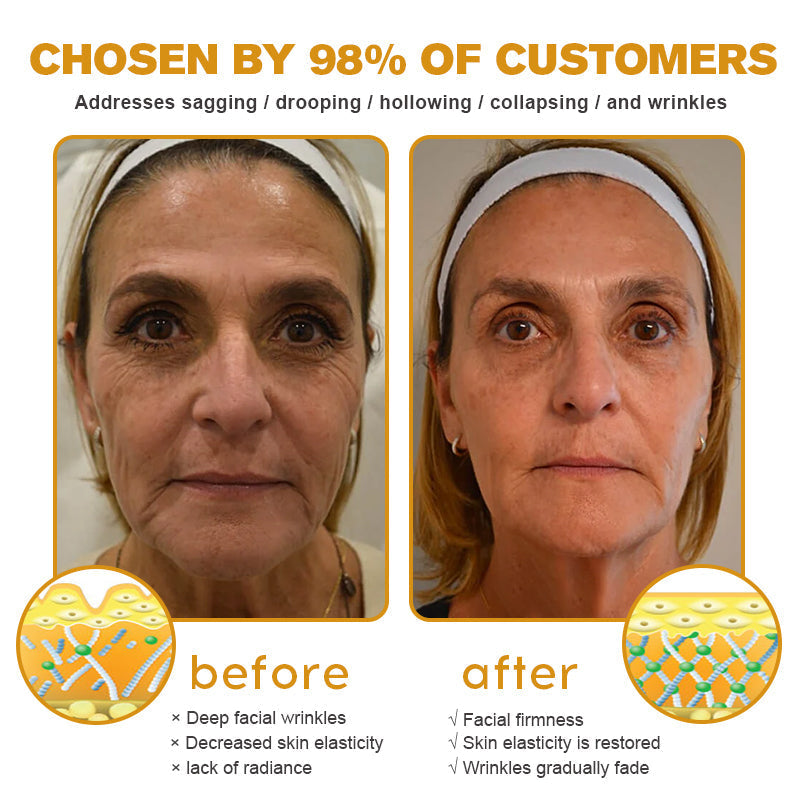 👨‍⚕️ Made and Shipped from USA✅ TLOPA™ Botox Bee Venom Wrinkle Removal Cream- LAST DAY 80% OFF
